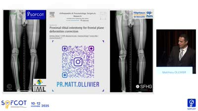 Conférence d'enseignement : CE 16 Technique Des Ostéotomies Tibiales Proximales