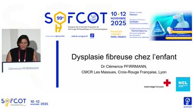 Conférence d'enseignement : CE 02 Dysplasie Fibreuse Chez L’Enfant