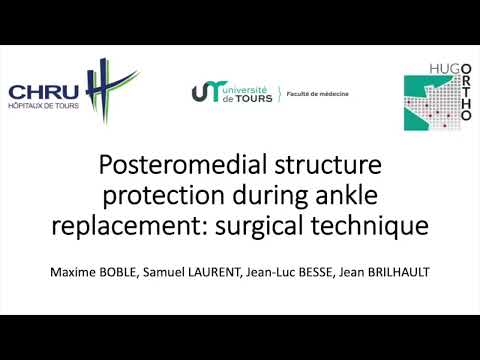 Vidéo du mois novembre 2022 : Posteromedial structure protection during ankle replacement: Surgical technique